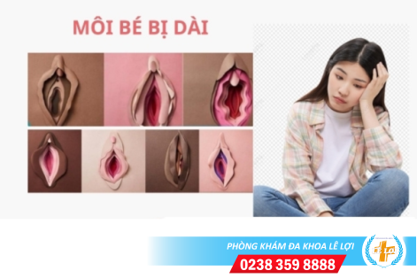 Môi bé bị dài phải làm sao?