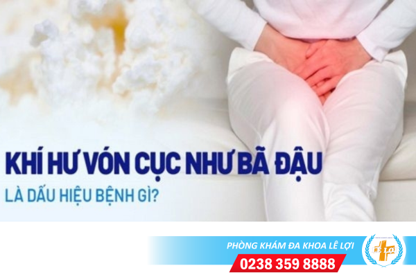 Huyết trắng bã đậu, vón cục, dạng bột đặc là bị gì?