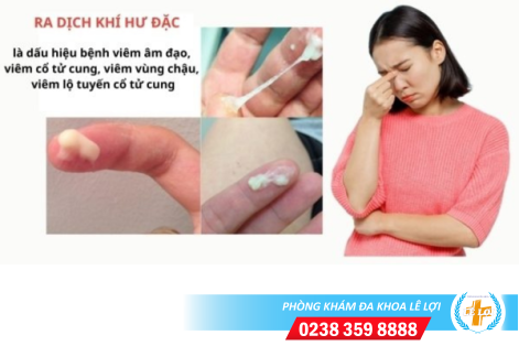 Ra dịch khí hư đặc là bị gì?