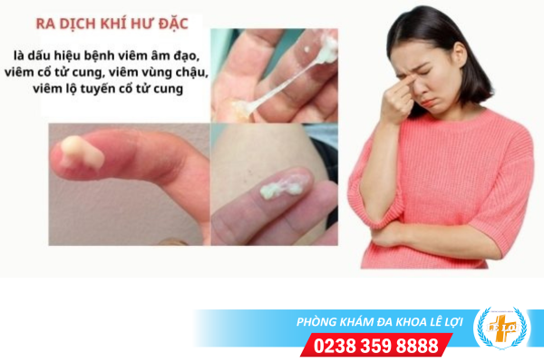 Ra dịch khí hư đặc là bị gì?