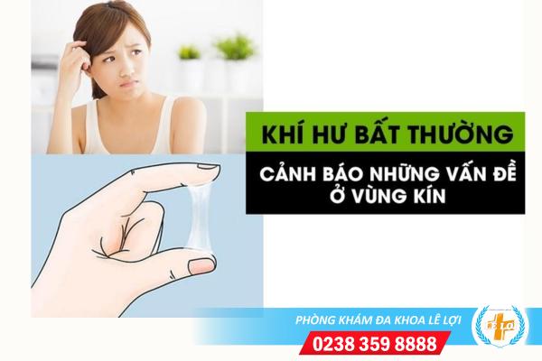 Những thông tin về bệnh khí hư