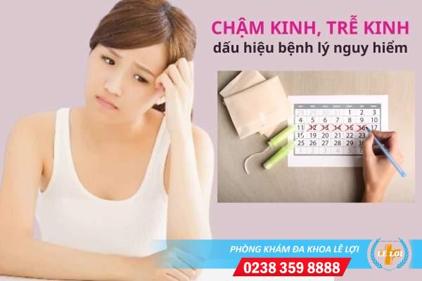 Những thông tin về hiện tượng chậm kinh, trễ kinh ở nữ giới