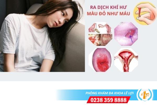 Ra dịch khí hư màu đỏ như máu nguyên nhân và cách điều trị