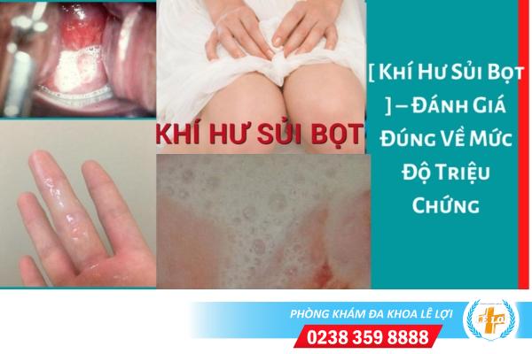 Khí hư có bọt và những nguyên nhân thường gặp