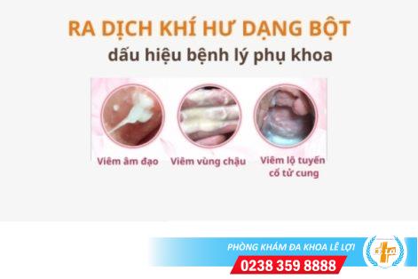 Ra dịch khí hư dạng bột là bệnh gì nguy hiểm không?