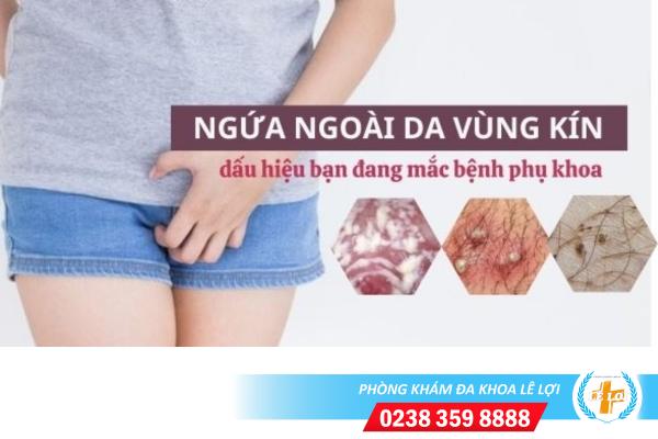 Bị ngứa ngoài da vùng kín là bệnh gì?