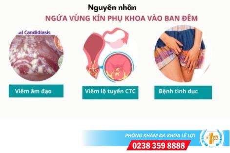 Ngứa vùng kín phụ khoa vào ban đêm nguy hiểm không?