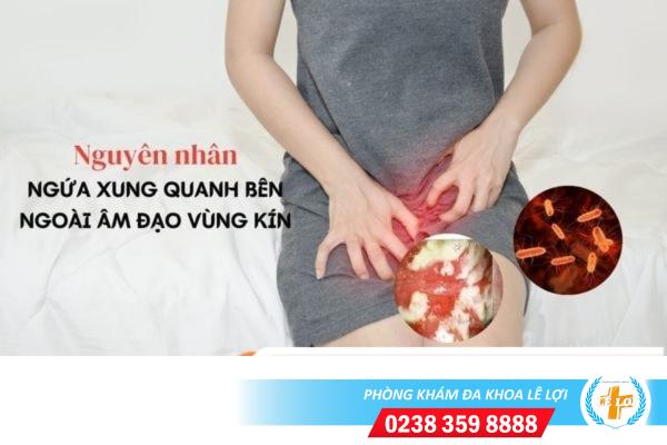 Nguyên nhân ngứa xung quanh bên ngoài âm đạo vùng kín