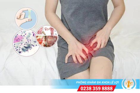 Bệnh trùng roi trichomonas là gì nguy hiểm không?