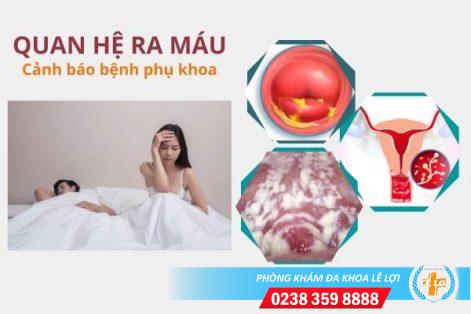 Quan hệ ra máu có nguy hiểm không?