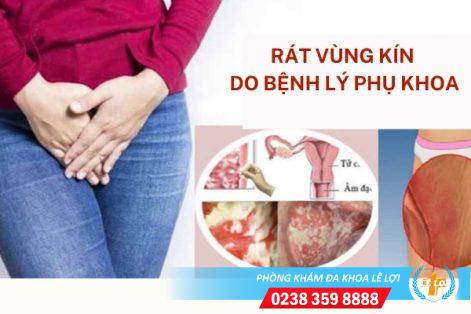 Nguyên nhân rát vùng kín ở nữ giới