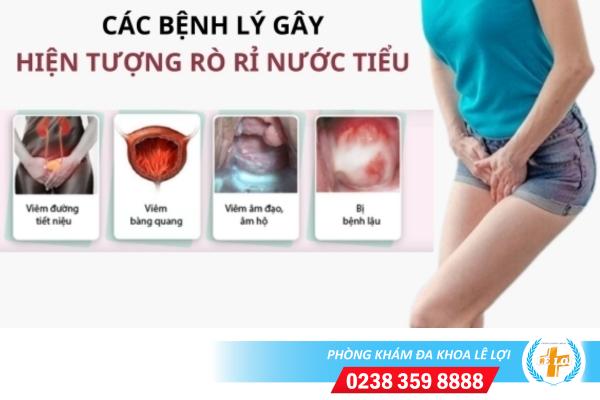 Hiện tượng rò rỉ nước tiểu nguyên nhân và cách khắc phục