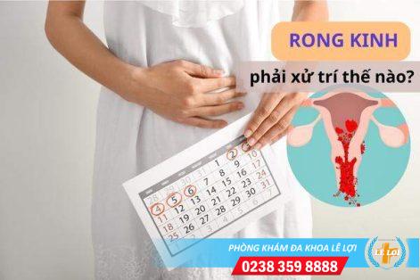 Một số vấn đề liên quan đến tình trạng rong kinh ở nữ