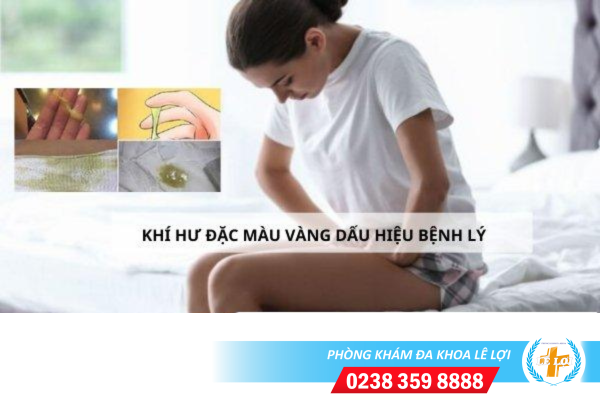 Khí hư đặc màu vàng, dịch âm đạo màu vàng là bệnh gì?