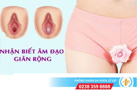 Dấu hiệu âm đạo vùng kín bị rộng