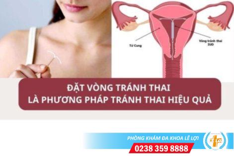 Cách tránh thai an toàn, hiệu quả