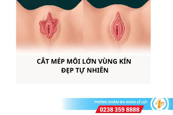 cat-mep-moi-lon-vung-kin-the-nao