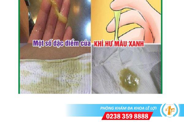 Ra dịch âm đạo màu xanh là mắc bệnh phụ khoa gì?