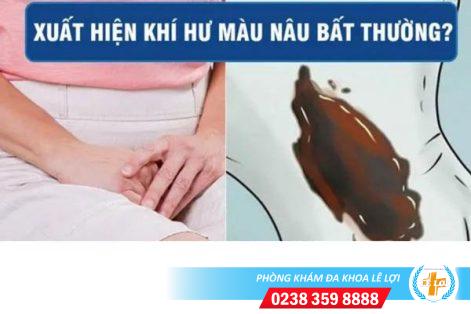 Cách chữa khí hư dịch âm đạo màu nâu hiệu quả