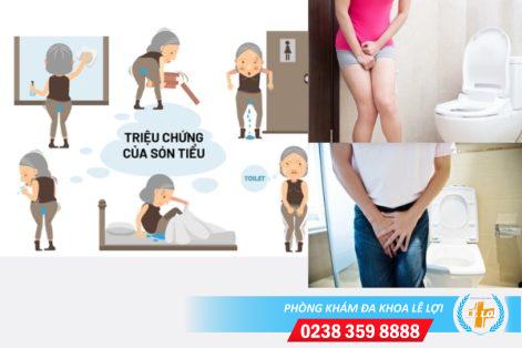 Điều trị són tiểu thế nào?