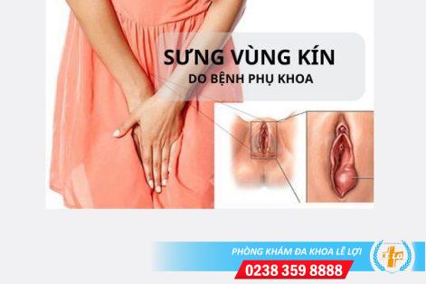 Sưng vùng kín nguyên nhân tác hại và cách điều trị