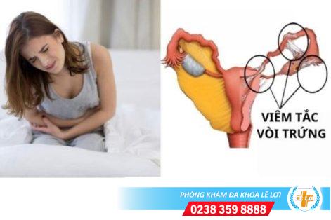 Dấu hiệu bị viêm tắc vòi trứng và cách điều trị